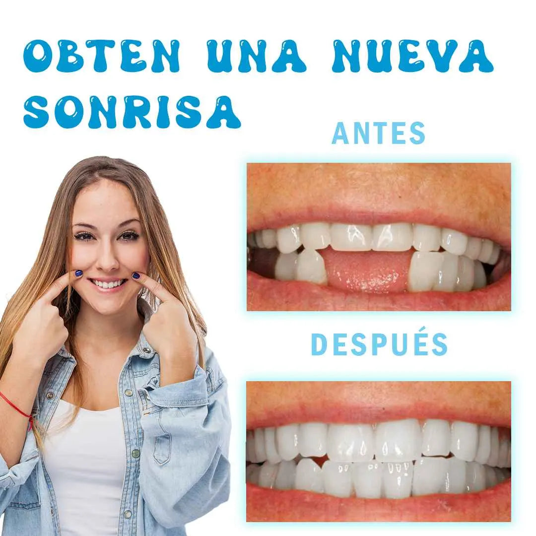RESINA DENTAL: Dile Adiós a eso Dientes rotos🦷