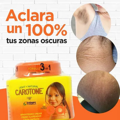 Crema aclarante carotone 135 ML: Dile Adiós a las manchas oscuras