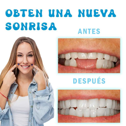 RESINA DENTAL: Dile Adiós a eso Dientes rotos🦷